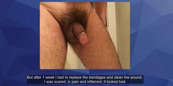 Circumcision? Check this out