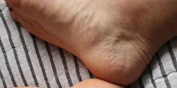 Feet 223