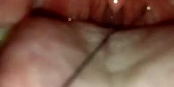 anal