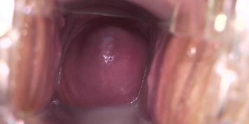 Puddle around her Cervix (Gina Devine)
