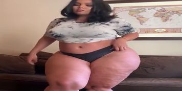obese legs thick