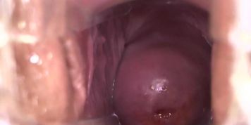 Tess's Tube