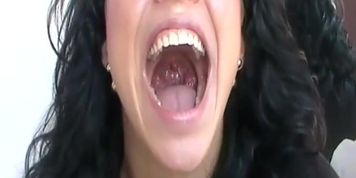 5567876