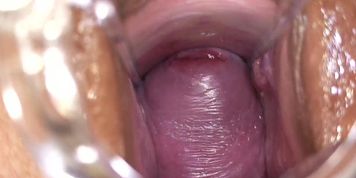 Sweet Cervix