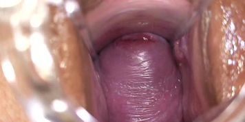 Cervix Station
