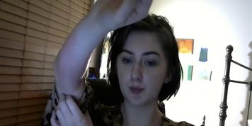 Teen Has Real Allergic Reaction Must See Top Ten Hottest Rashes (sssniperwolf)