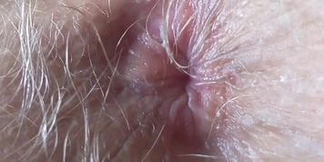 Winking my unwashed stinker ? by hairyblondie from OnlyFans | Coomer