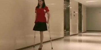 SAK Amputee Girl