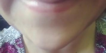 Pucker