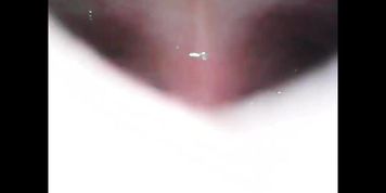 Endoscope Stomach Vore Vid