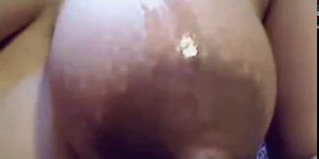 pregnant areola