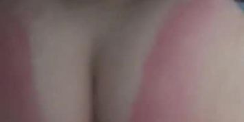 clapping big white ass sunburnt
