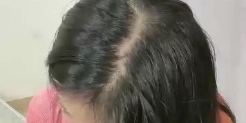 ???????????????????????????BB?????????????????? (1)