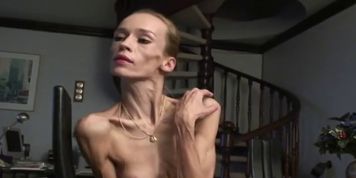 Anorexic Milf Inna 20