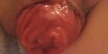 Close up Prolapsing (relaxed)