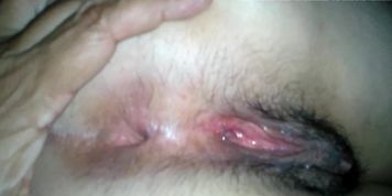 pretty anus