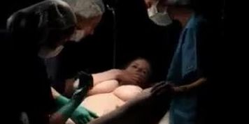 Lesbian Clitoral Stimulation Surgery