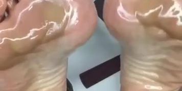 oily soles