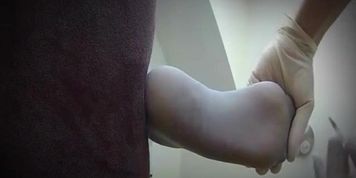 injection at foot 1