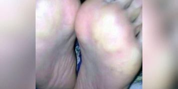 Pelmata
