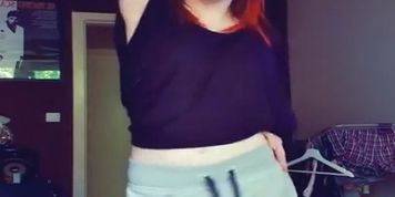 amputee