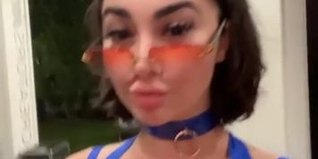 Liz | Lupuwellness