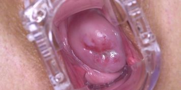 Belle's cervix is worth staring at forever