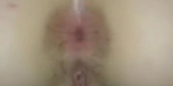 Teen anal gape