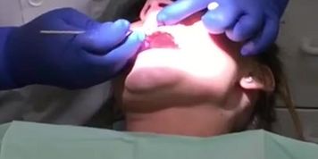Girl gets prophy cleaning 