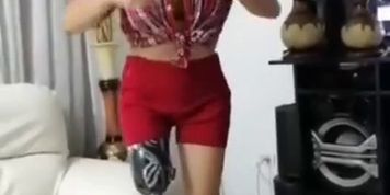 dance with fake leg