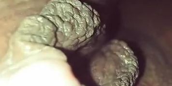 FatClit