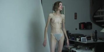 Anorexic Gals