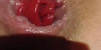 Anal and gape close up