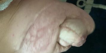 Bbw amputee stump massage clip