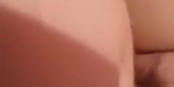 Camel toe
