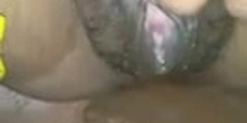 After full night sex pussy was injured