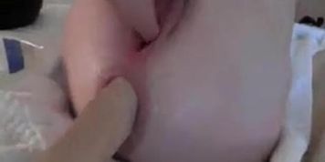 Wild and hard anal fisting with a massive prolapse
