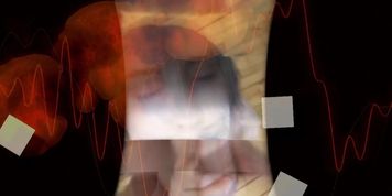 Amateur Oral Overload v06 - Dissociative Edition [PMV]