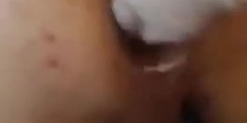 Fisting