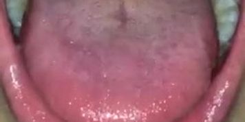 Chinese Teen Uvula 2