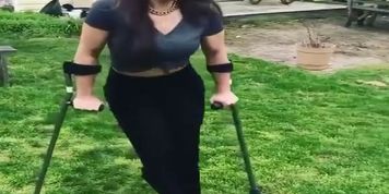 Hot Crippled Girl Crutching Around