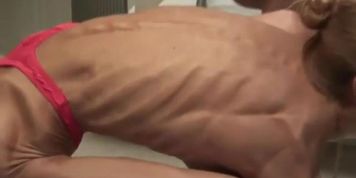 AnorexicLovers - Inna 18